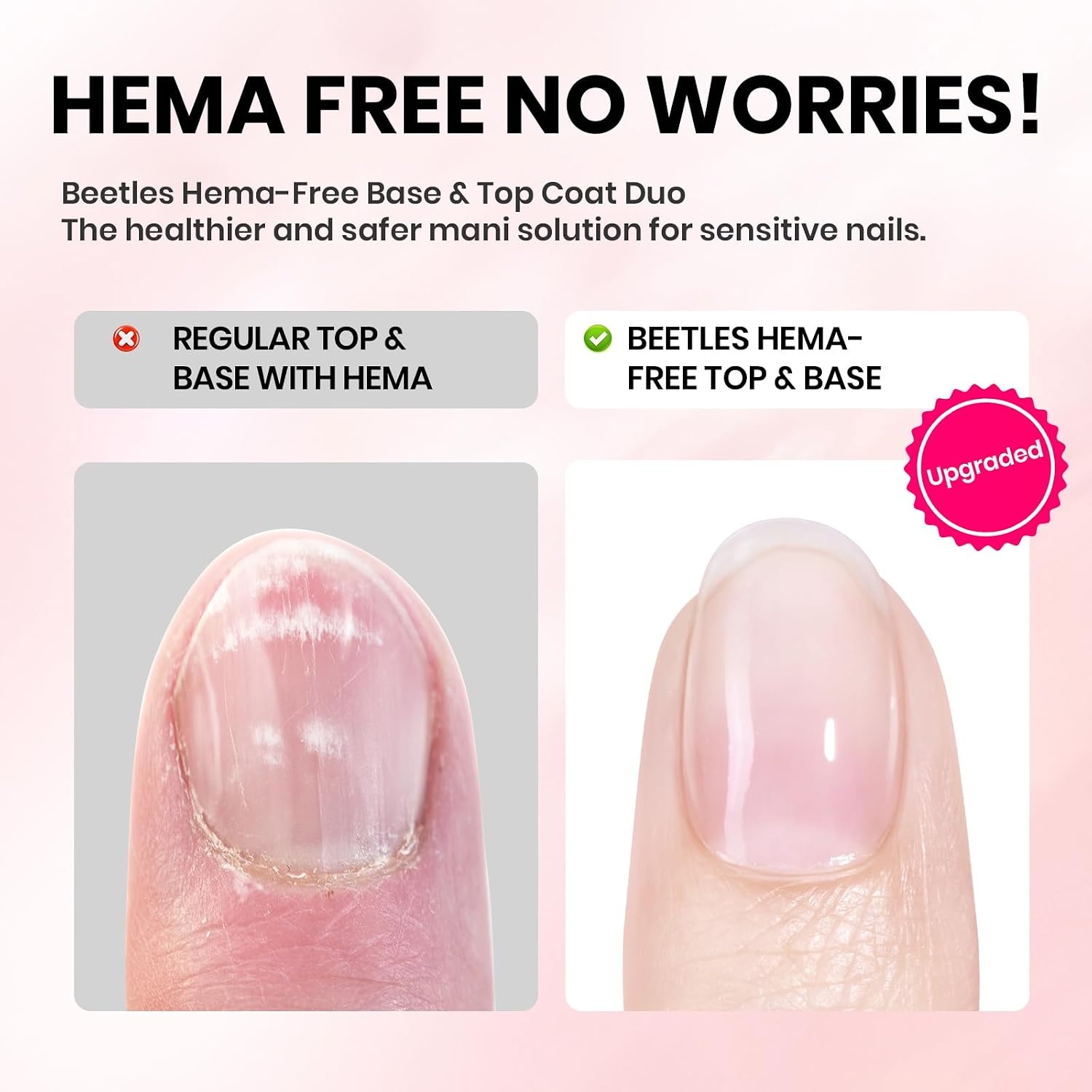 image:imageBeetles HEMA Free amp TPO Free Gel Base and Top Coat Set No Wipe Top Coat Soak Off UV LED Gel Polish Foundation Kit for Long Lasting High Gloss Manicure10Clear 15ml Top Base HEMA Free